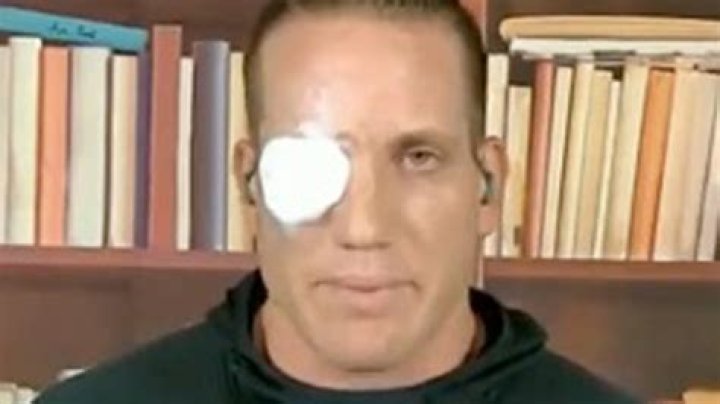 AJ Hawk's Eye Injury: A Journey Through Adversity