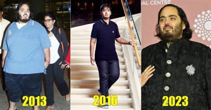 Anant Ambani's Health Woes: A Detailed Update