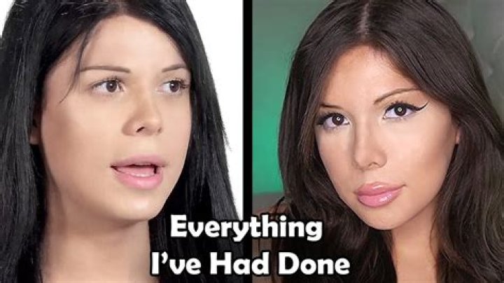 Blaire White's Journey: The Truth Behind Her Surgery