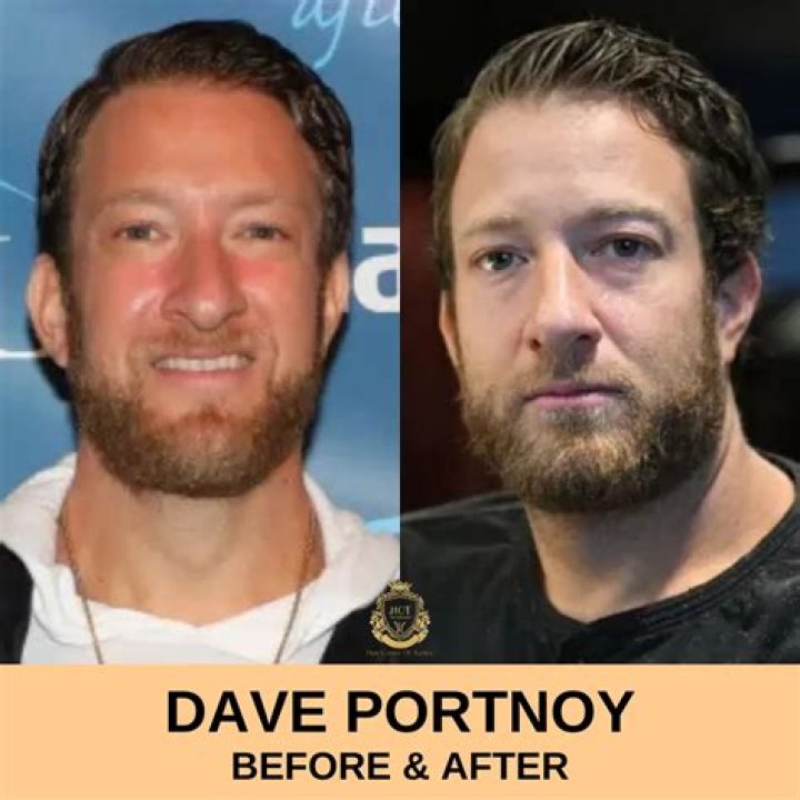 Dave Portnoy's Incredible Transformation: Before And After