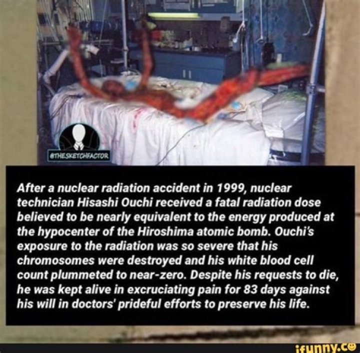 Did Hisashi Ouchi Survive? The Tragic Fate Of The Nuclear Engineer
