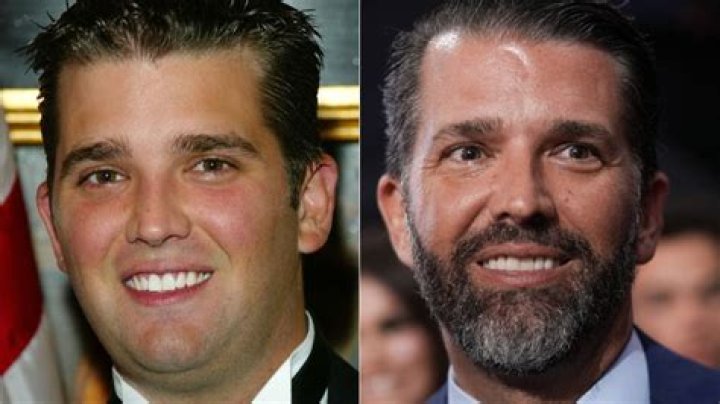 Unveiling The Truth: Donald Trump Jr. And The Speculation Around Plastic Surgery