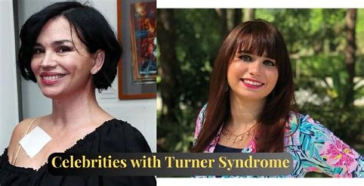 Fascinating Turner Syndrome Celebrities: Uncovering Their Stories And Impact