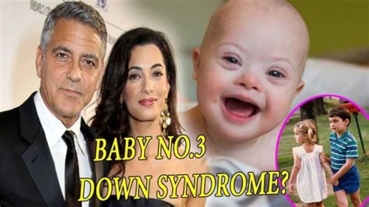Exploring The Truth: Is One Of George Clooney's Twins Down Syndrome?