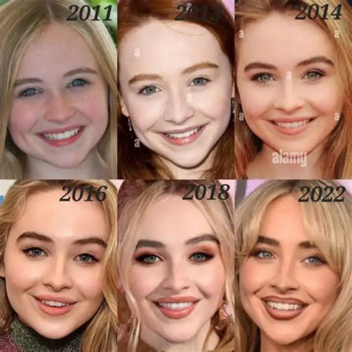 Is Sabrina Carpenter's Transformation The Result Of Plastic Surgery?