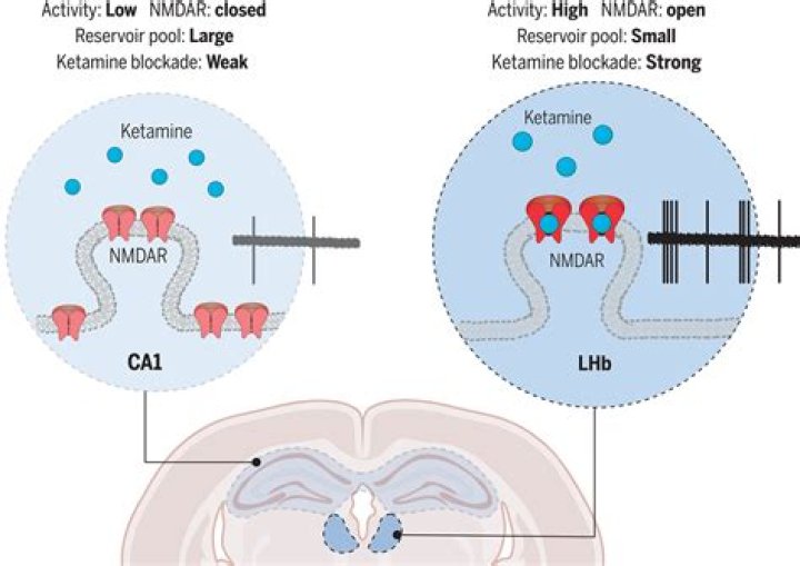 Ketamine Induced Coma Houses: A Guide To Safe And Effective Treatment