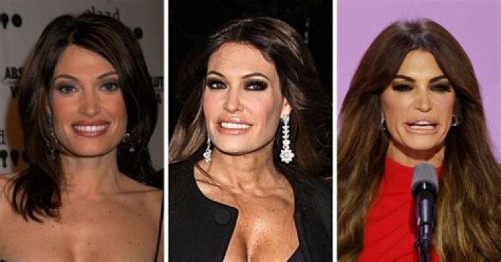 Kimberly Ann Guilfoyle's Plastic Surgery: Before And After Transformation
