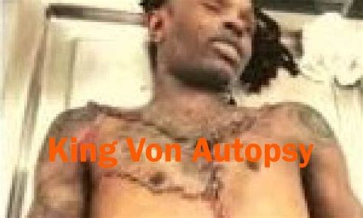 Unveiling The Truth: The King Von Autopsy Picture And Its Impact