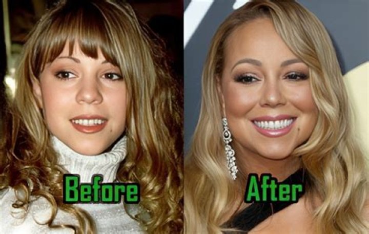 Unveiling The Transformation: Mariah Carey And Her Plastic Surgery Journey