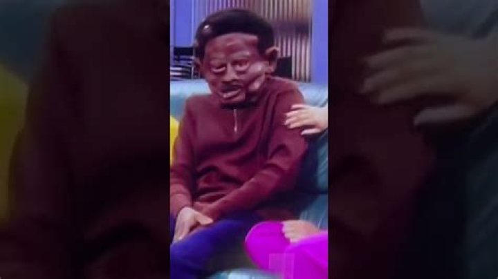 Behind Martin's Swollen Face: Shocking Revelation!