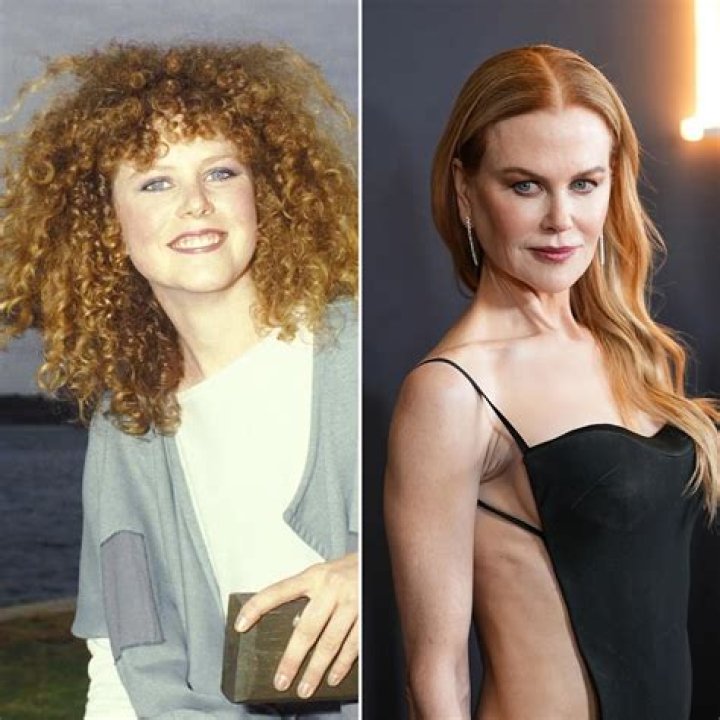The Unfiltered Truth: Nicole Kidman's Plastic Surgery Journey Revealed