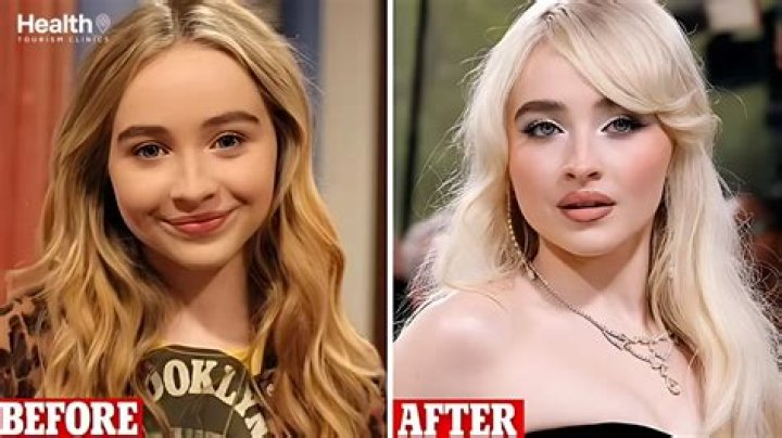 The Truth About Sabrina Carpenter's Plastic Surgery Rumors