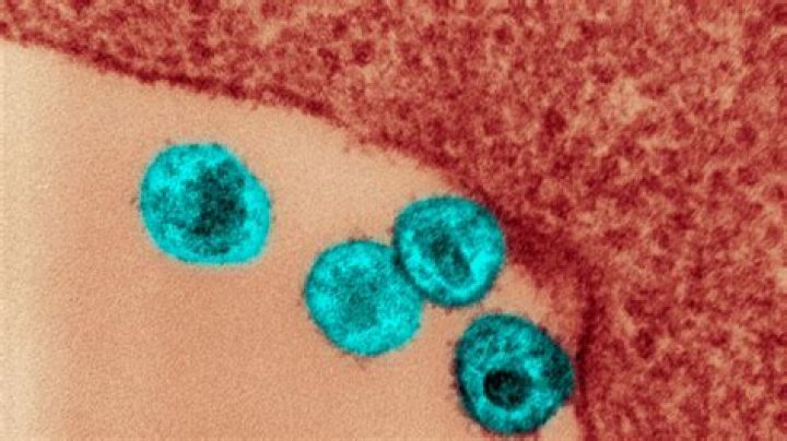 Breakthrough: Third HIV Cure Announced By Scientists!